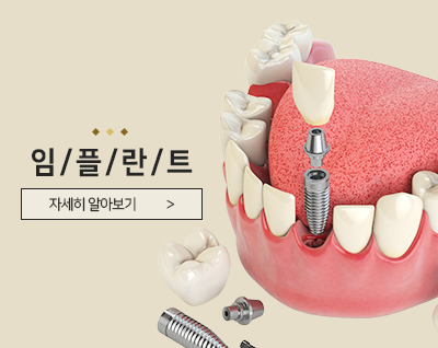 임플란트 바로가기
