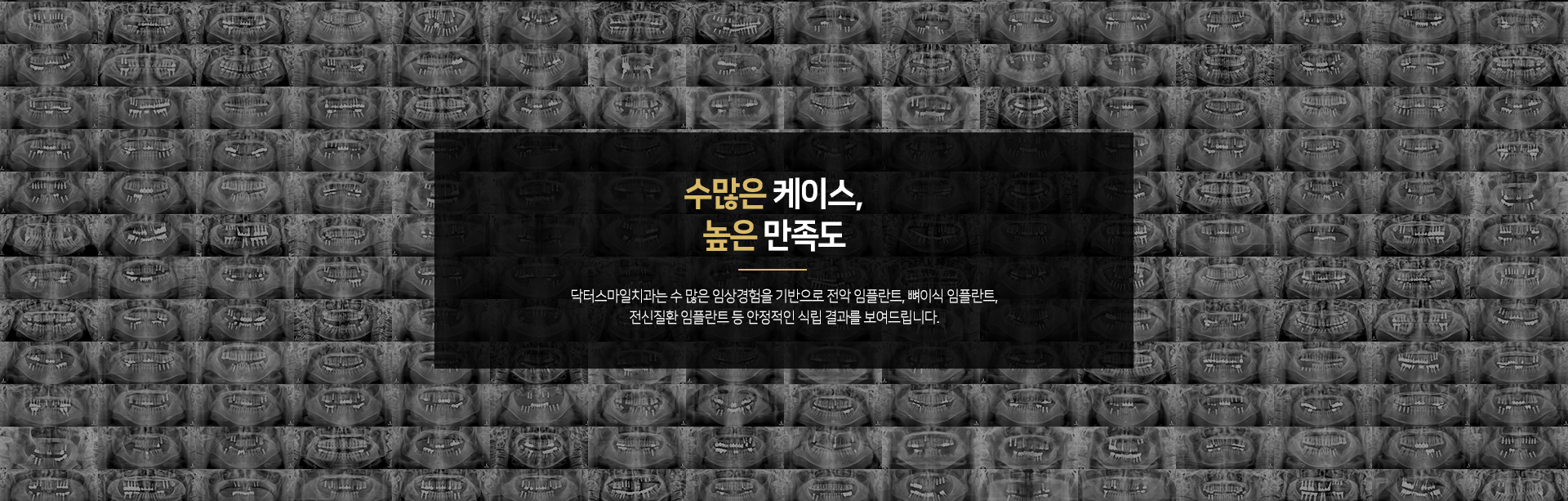 수많은 케이스 높은 만족도